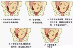 胎儿入盆图,图解与症状详解”